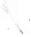 Fig. 07 - Methods and systems for attaching tissue to bone
