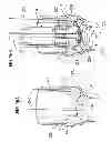 Fig. 09 - Knotless suture anchoring devices and tools for implants