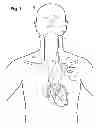Fig. 02 - Implantable device for evaluating autonomic cardiovascular drive in a patient suffering from chronic cardiac dysfunction