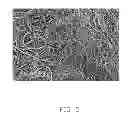 Fig. 06 - Pacemakers and pacemaker electrodes