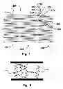 Fig. 02 - Support Structure For An Endoprothesis, An Endoprotheses And Associated Methods