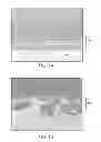 Fig. 02 - Surgical methods for breast reconstruction or augmentation