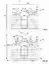 Fig. 09 - Method And Apparatus For Manufacturing An Implant