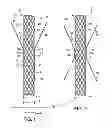 Fig. 02 - Anti-Leakage Prosthesis