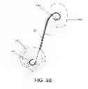 Fig. 07 - Ureteral stent drug delivery device, kit, and method