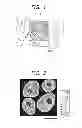 Fig. 02 - Method of forming mass image