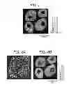 Fig. 04 - Method of forming mass image