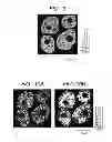 Fig. 06 - Method of forming mass image