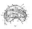 Fig. 07 - Headgear attachment for portable audio device