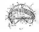 Fig. 09 - Headgear attachment for portable audio device
