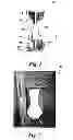 Fig. 02 - CASTING METHODS FOR MAKING ARTICLES HAVING A FINE EQUIAXED GRAIN STRUCTURE