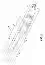 Fig. 05 - Object separator for ink jet printer applications