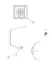 Fig. 02 - Method and device for determining the eye torsion