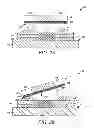 Fig. 03 - SURFACE MOUNT COMPONENT HAVING MAGNETIC LAYER THEREON AND METHOD OF FORMING SAME
