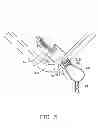 Fig. 06 - Portable electronic device with pendant attachment device
