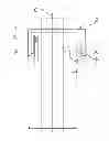 Fig. 01 - Dental X-ray device with imaging unit for surface detection and method for generating a radiograph of a patient