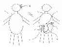 Fig. 01 - Hearing aid system and a microphone device