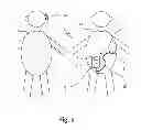 Fig. 02 - Hearing aid system and a microphone device