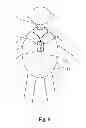 Fig. 06 - Hearing aid system and a microphone device