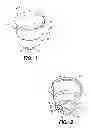 Fig. 02 - Syringe sterilization cap