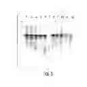 Fig. 04 - Method and medicament for inhibiting the expression of a given gene