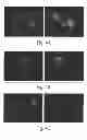 Fig. 05 - Method and medicament for inhibiting the expression of a given gene