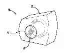 Fig. 01 - Illuminated dental prop