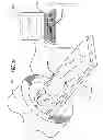 Fig. 02 - Devices and methods for enhancing bone growth