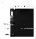 Fig. 06 - MICROFLUIDIC CHIP DEVICE FOR SELECTING A CELL APTAMER AND METHOD THEREOF