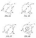 Fig. 07 - Plasma reactor with adjustable plasma electrodes and associated methods