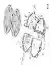 Fig. 06 - Electrical cord connection covering techniques