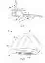 Fig. 10 - Golf club head