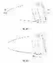 Fig. 16 - Golf club head