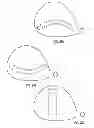 Fig. 17 - Golf club head