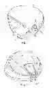 Fig. 02 - Golf club having removable weight