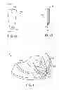 Fig. 06 - Golf club having removable weight