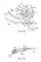 Fig. 22 - Golf club having removable weight