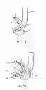 Fig. 09 - Golf club head with top line insert