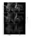 Fig. 35 - SAPP-ALPHA AS A BIOMARKER FOR PREDICTION OF INFLAMMATORY AND AUTOIMMUNE-RELATED DISORDERS
