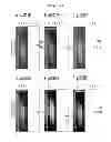 Fig. 09 - Cloning and base sequence determination of novel iturin biosynthesis gene from antagonistic microorganism and characteristics of the gene