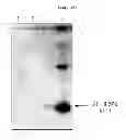Fig. 17 - Cloning and base sequence determination of novel iturin biosynthesis gene from antagonistic microorganism and characteristics of the gene