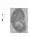 Fig. 07 - Method and system for administering radiopharmaceutical therapy (RPT)