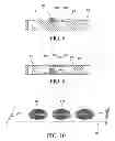 Fig. 05 - ORTHOPEDIC FIXATION DEVICE WITH MAGNETIC FIELD GENERATOR