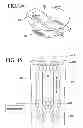 Fig. 08 - ORTHOPEDIC FIXATION DEVICE WITH MAGNETIC FIELD GENERATOR