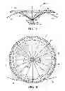 Fig. 02 - System for improving cardiac function by sealing a partitioning membrane within a ventricle