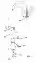Fig. 28 - System for improving cardiac function by sealing a partitioning membrane within a ventricle