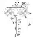Fig. 09 - IMPLANTATION OF A HEARING PROSTHESIS