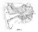 Fig. 02 - Magnet arrangement for bone conduction hearing implant