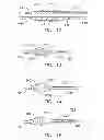Fig. 06 - Rotate-to-advance catheterization system