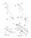 Fig. 08 - Rotate-to-advance catheterization system